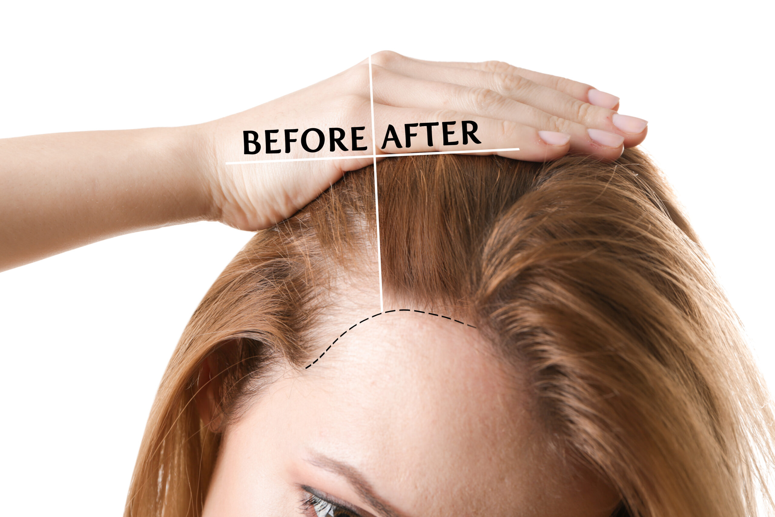 how to prevent hair fall for female