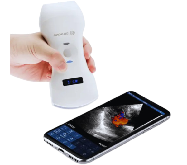 Tri-scan Max portable ultrasound scanner